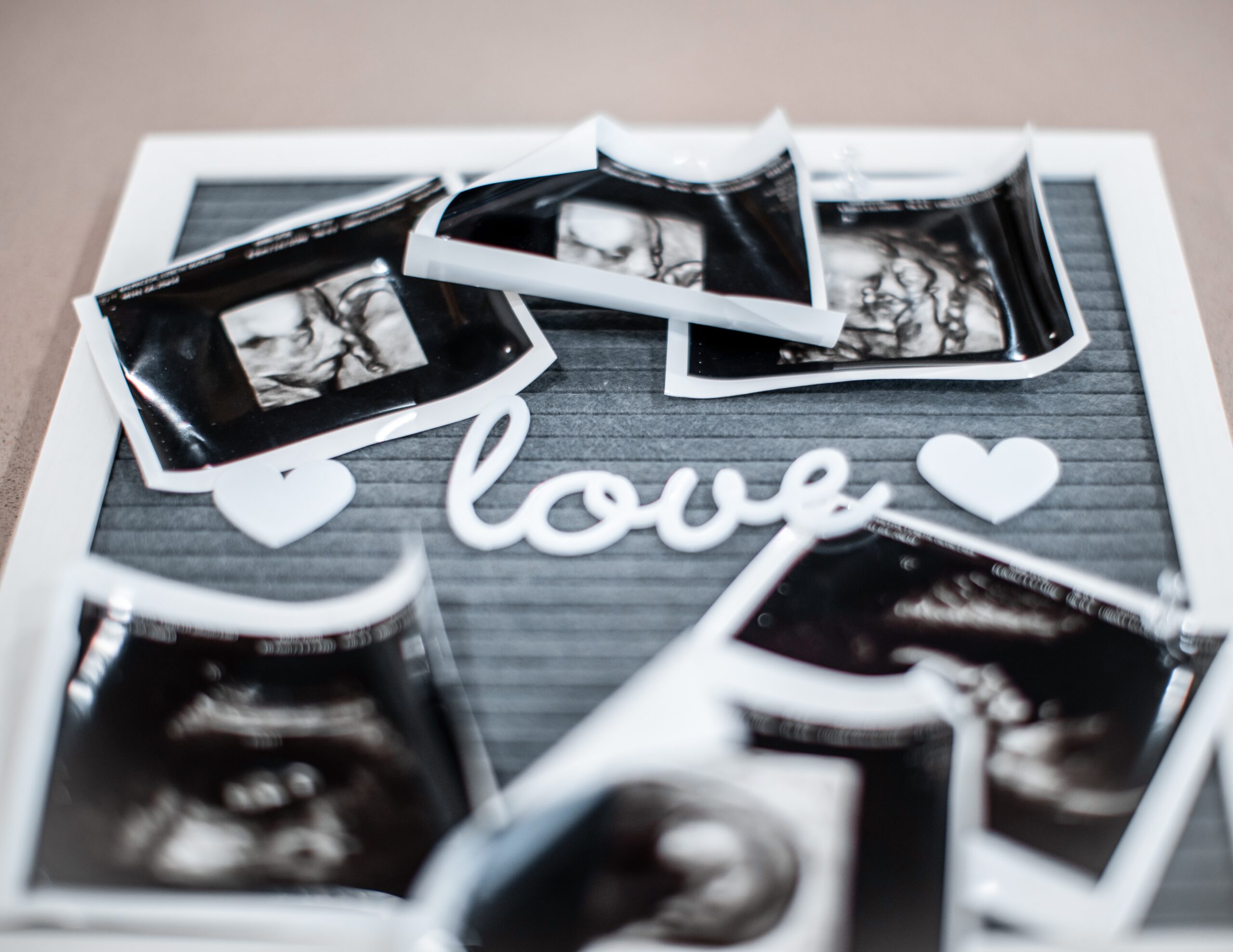 Babyscanphotofertilitydevon